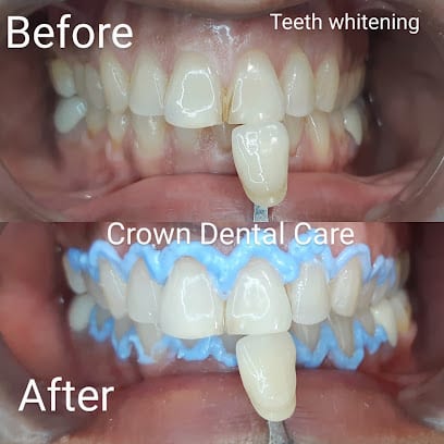 CROWN DENTAL CARE. LOWER PAREL WEST. DR SHRADDHA SHETE BHOSLE.