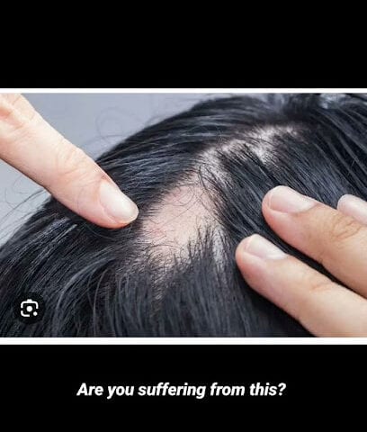 Dr Meenakshi Jain Homeopathy Clinic - Laser Hair Removal, Hair Fall & Hair Thinning | PRP | Hydra Facial in Parel